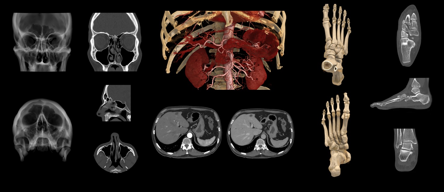 Das komplette radiologische Untersuchungsspektrum deckt der neue CT ab, bis zu Trauma-CTs. Foto: Canon Medical