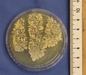 Abb. 1 : Abklatschpräparat vor hygienischer Händedesinfektion (Foto: dvta).