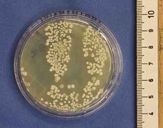 Abb. 2: Selbe Hand nach hygienischer Händedesinfektion mit bereits deutlich...
