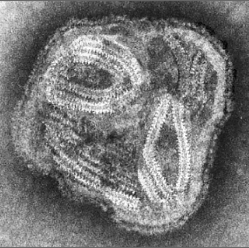 Photo: RS-Virus infiziert schwerkranke Patienten in der Medizinischen...