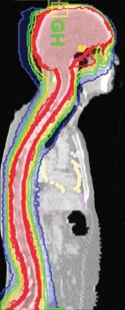 Photo: Universitätsklinikum Magdeburg setzt auf das innovative Strahlentherapie