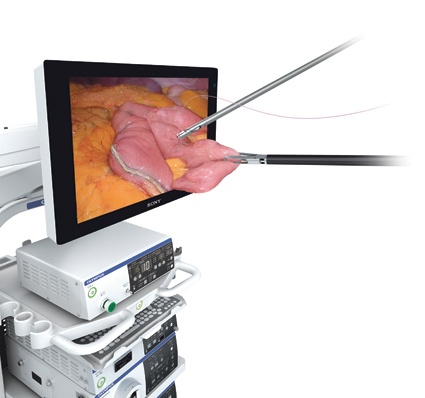 Gewinner der Kategorie A Medizin & Technik - Sieger 2: Olympus Deutschland -...