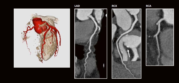 Fall 2: 40-jähriger Mann, Architekt. Bei Stress auf den Baustellen deutlich...