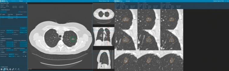 Volumetrische Verlaufskontrolle