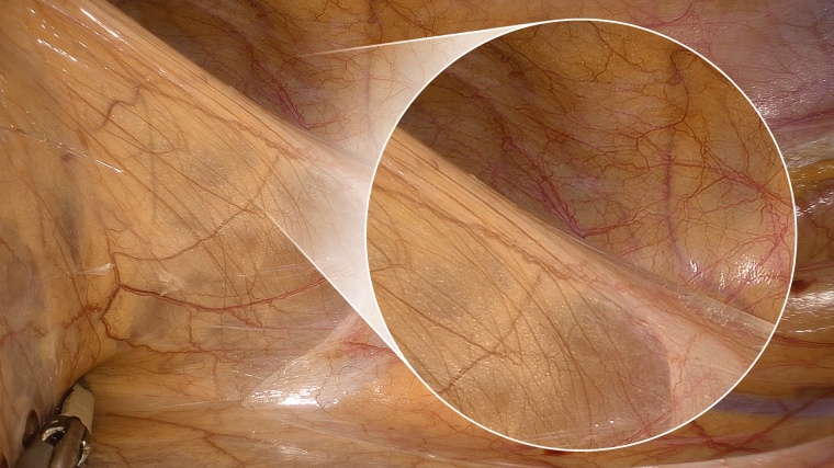 Der Slogan GET CLOSER bringt es auf den Punkt, um wie viel näher dran die...