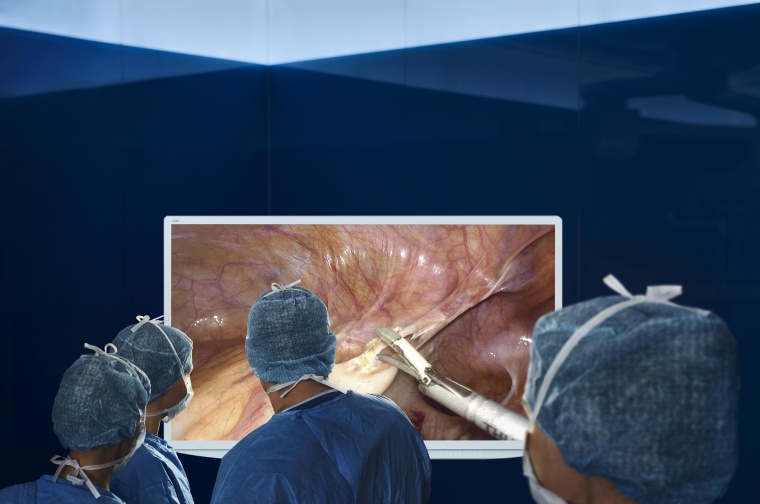 VISERA 4K UHD: Perfekte Sichtverhältnisse dank großem Monitor, vierfacher...