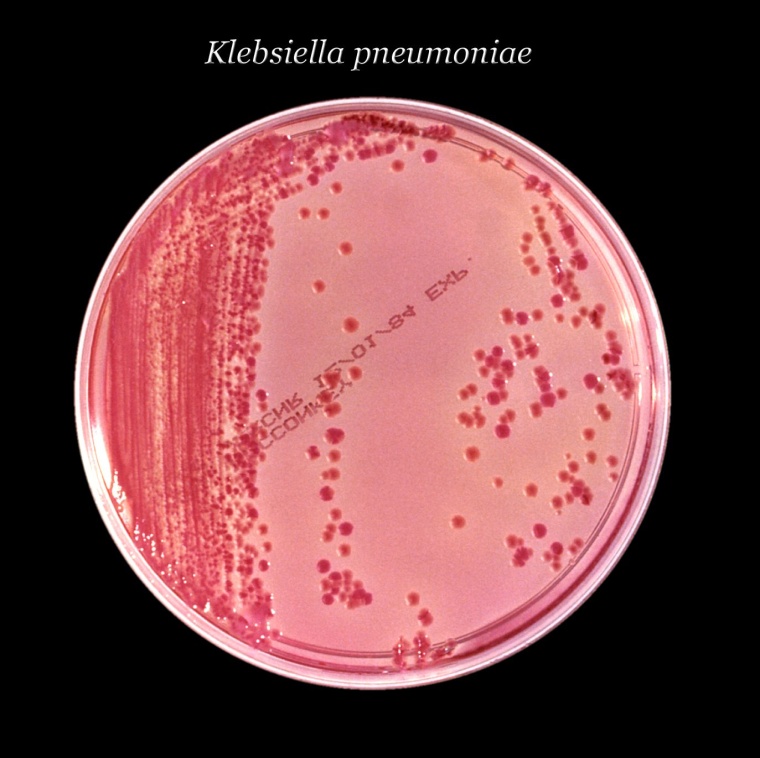 Klebsiella pneumoniae gehört zu den häufigsten Erregern in Kliniken. Ein...