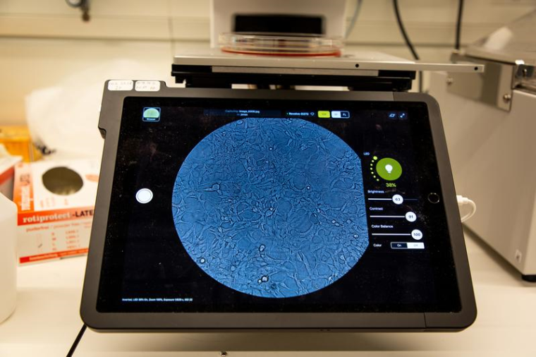 Nichtinfizierte HEK-293-Zellen unter dem Mikroskop: Diese Linie aus...