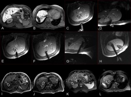 Legende zu den Abbildungen siehe Haupttext.