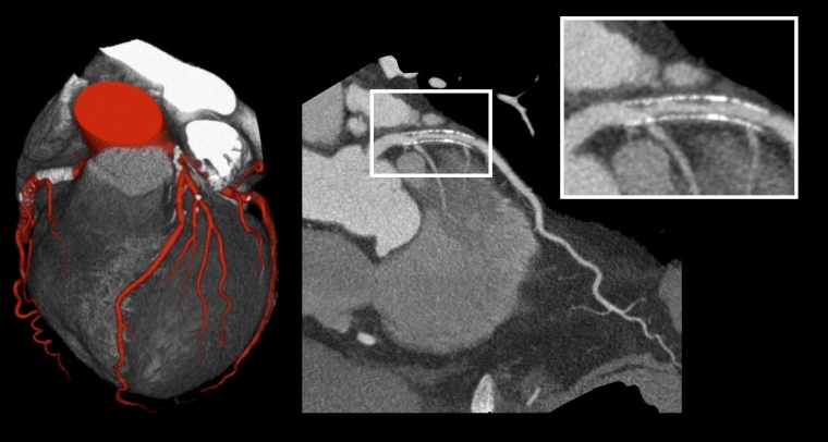 Klinische Bilder, wir hier am Beispiel der Herzbildgebung, werden von den neuen...