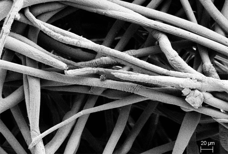 Abb. 1: Rasterelektronenmikroskopische Aufnahme einer mit Zinkoxid...