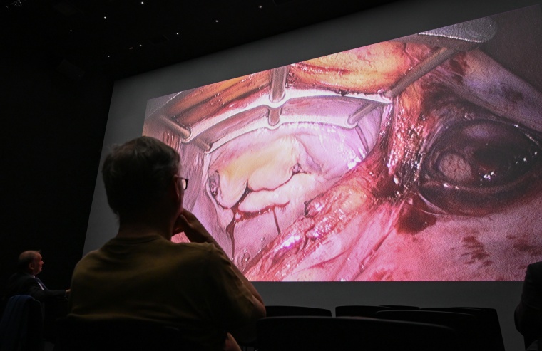 Live-Herz-OP. Foto: JKU