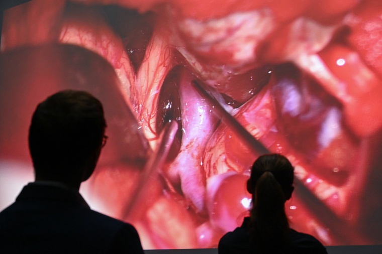 Live-OP Hirnaneurysma. Foto: JKU