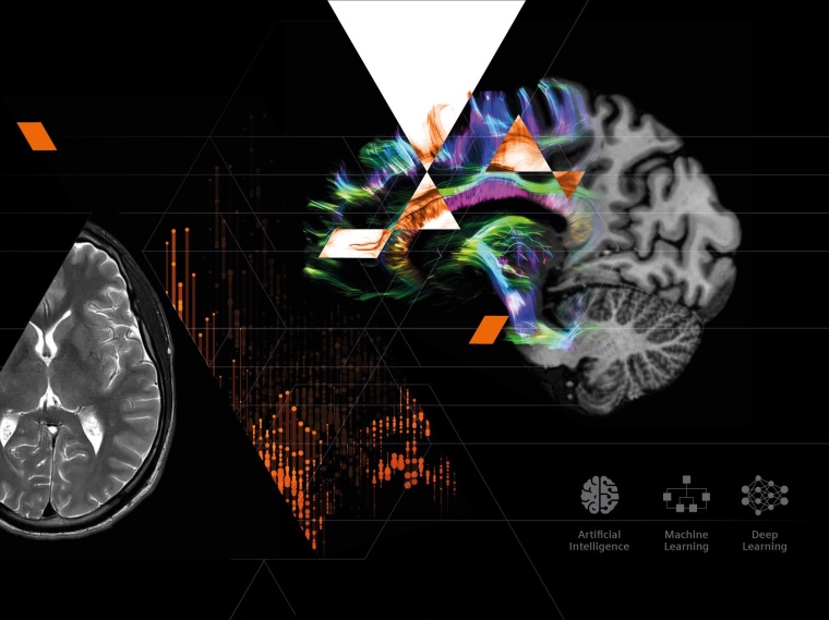 Generative KI in der Radiologie Foto: Siemens Healthineers