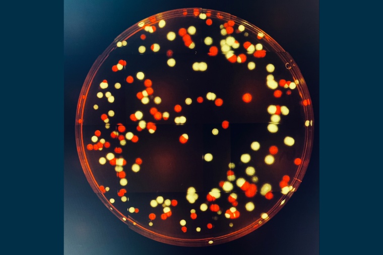 P. aeruginosa-Bakterien, die mit einem gelbem oder roten Fluoreszenzmarker...