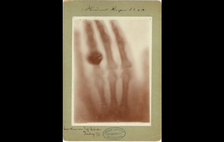 Aufnahme eines Versuchs zur Durchleuchtung verschiedener Gegenstände, hier...