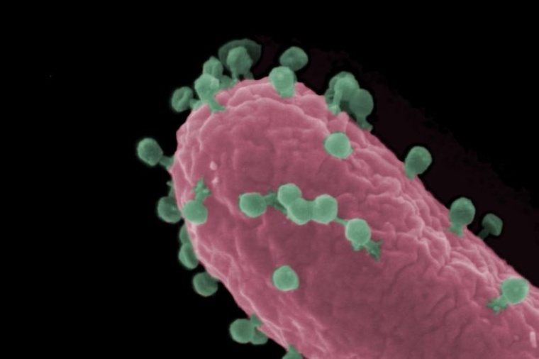 Rasterelektronenmikroskopische Aufnahme einer Escherichia coli-Zelle (rot), die...