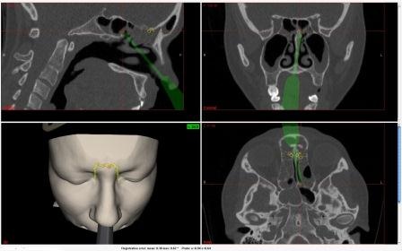 Das chirurgische Cockpit (auch OP-Saal der III. Generation) verfügt jetzt...