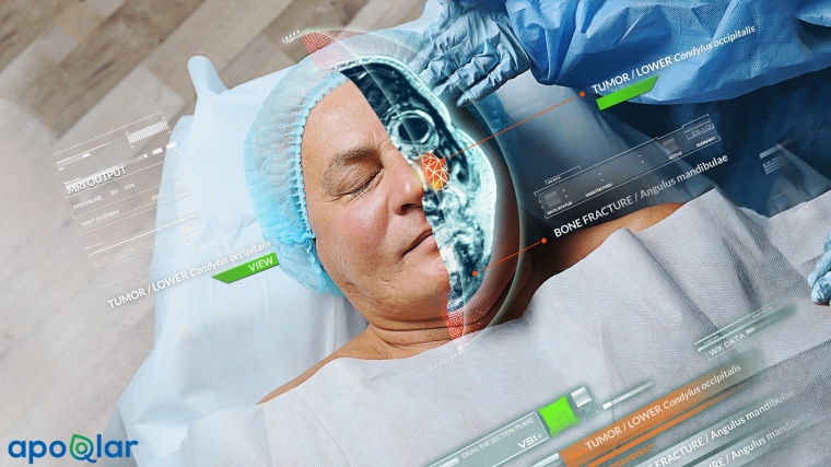 Das MRT-Bild wird mittels des VSI-Assistenten auf das zu operierende Objekt...