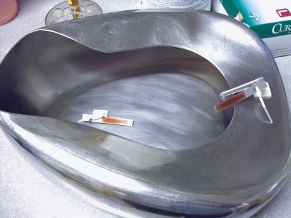 Unsaubere Steckbecken waren Ursache für einen Krankheits-Ausbruch durch...