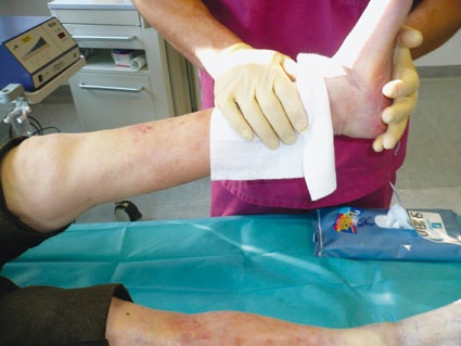 Mit Comfort Shiled können die drei Sparten der Wundversorgung – Reinigung,...