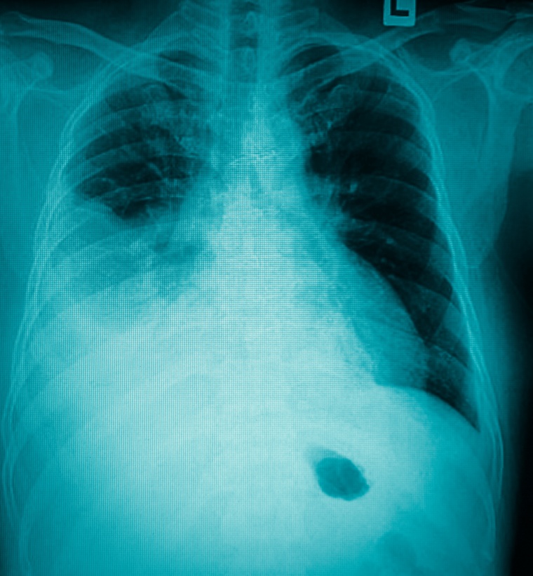 Wiley: Tewan Banditrukkanka/Shutterstock 256270639