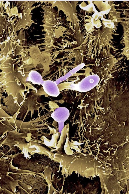 Der Hefepilz Candida albicans (violett eingefärbt) auf Epithelzellen. Foto:...