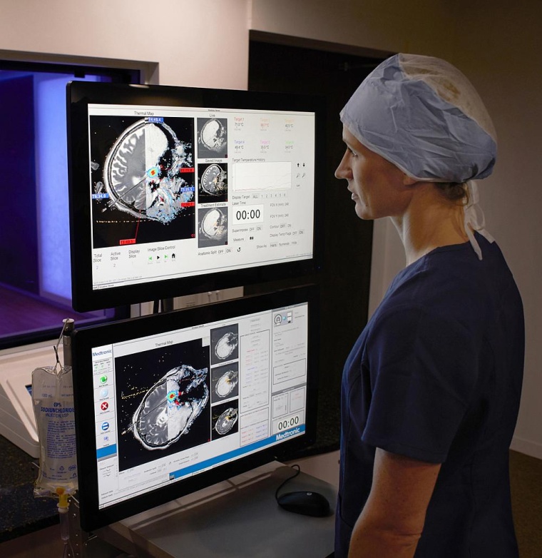 Die MRT-geführte Laserablationstechnologie Visualase erlaubt es dem Operateur...