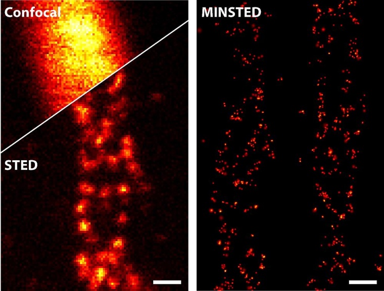 Verschiedene lichtmikroskopische Techniken im Vergleich: Bereits STED (links...