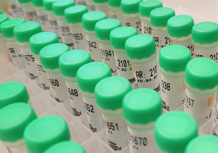 Probenröhrchen Foto: Charité | Victor Corman