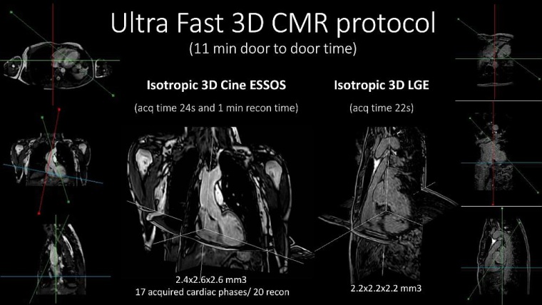 Ultraschnelles 3D CMR Protokoll. Foto: Philips