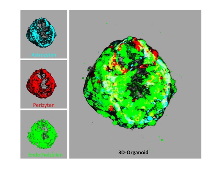 Konfokale Laserscanning-Mikroskopie Aufnahmen von 3D-Organoiden nach 120 h...