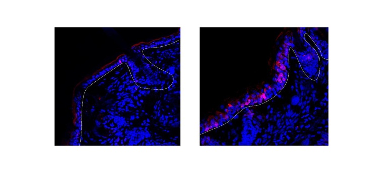 Keratinozyten mit dem Rezeptor für Interleukin-12 (links) teilen sich in der...