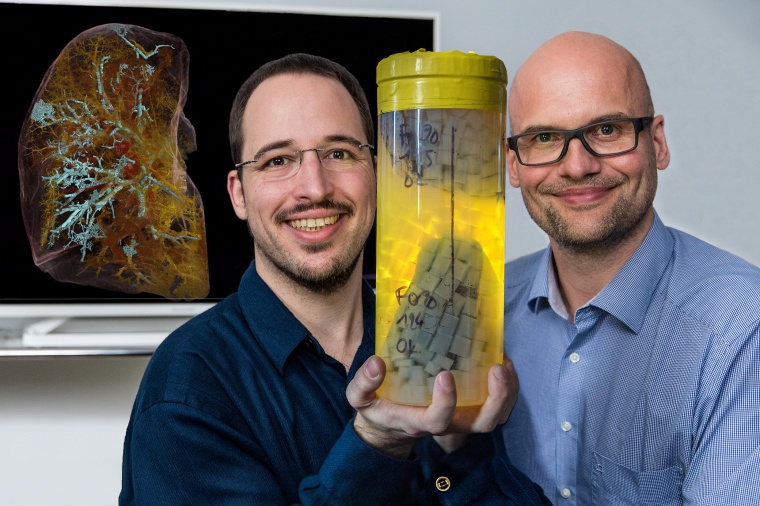Prof. Dr. Danny Jonigk (r.) und Christopher Werlein mit dem linken Oberlappen...