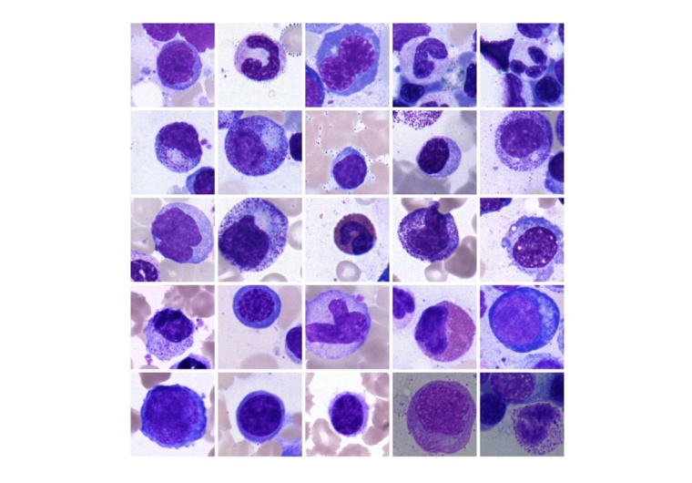 Künstliche Intelligenz erlaubt es, Knochenmarkszellen wie die hier...