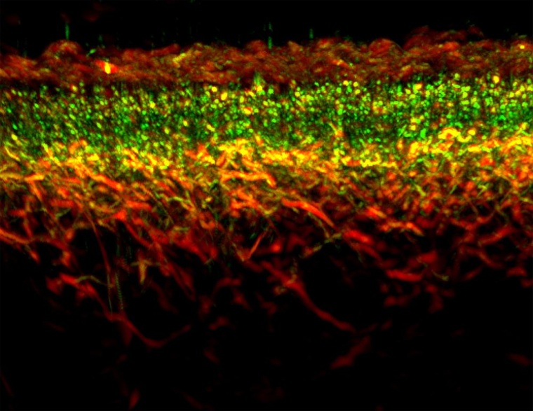 RSOM-Aufnahme von gesunder Haut. RSOM, kurz für Raster-Scan Optoacoustic...