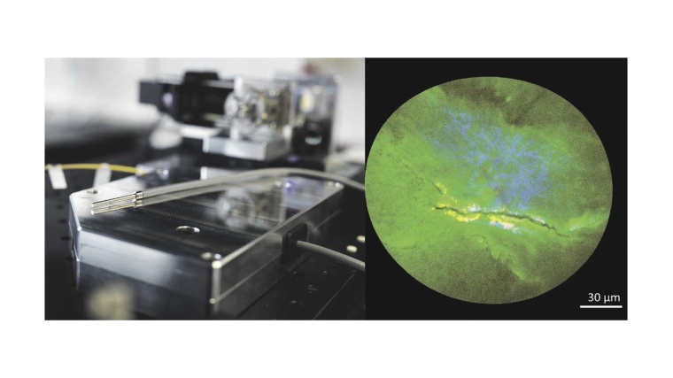 L.: Die multimodale Fasersonde zur Aufnahme von morphochemischen Gewebebildern....