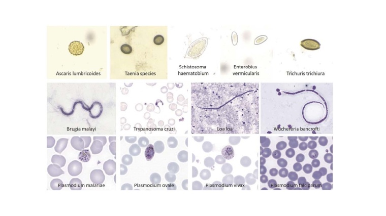 Ausschnitte der digitalisierten Probensammlung Foto: BNITM, Fraunhofer IIS