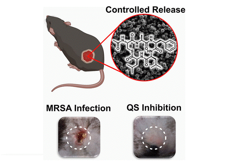 Neue Werkzeuge gegen Krankenhausinfektionen? Foto: Wiley-VCH