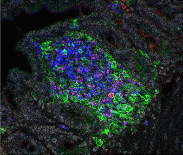 Unter dem Epithel des Dünndarms liegendes lymphoides Cluster, bestehend aus...