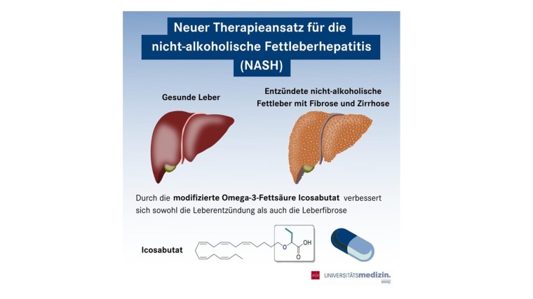 Für die Behandlung einer nicht-alkoholischen Fettleberhepatitis (NASH) haben...