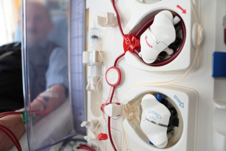 Bis zu zehn Jahre warten Dialysepatienten auf eine Spenderniere. © UKR/Klaus...