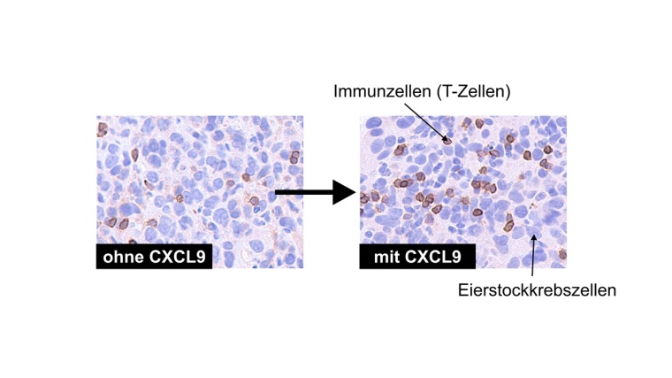 Der Botenstoff CXCL9 verbessert die Einwanderung von Immunzellen in...
