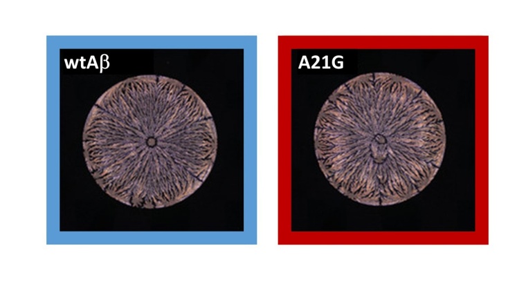 Neuronale Netzwerke erkennen kleinste Unterschiede in den Trocknungsmustern von...