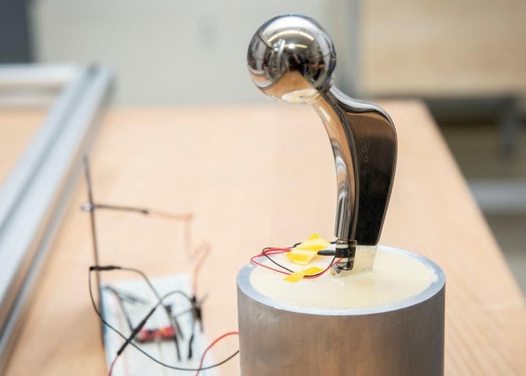 Die Hüftendoprothese implantiert in einen Kunstknochen. Für die Integration...