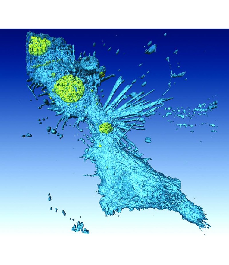 Lungenkrebszellen bei der Zellteilung, Foto: Bestvater/DKFZ