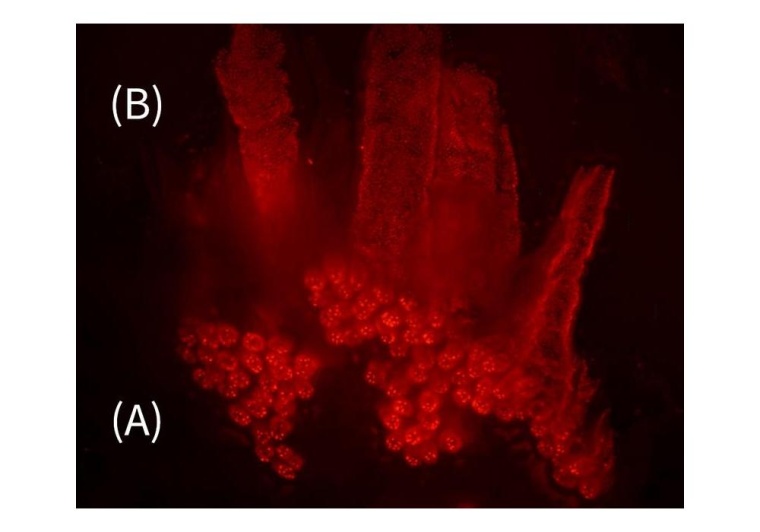 Fluoreszenzmikroskop-Aufnahme von Zellen im Darmepithel. Die neue Methode...