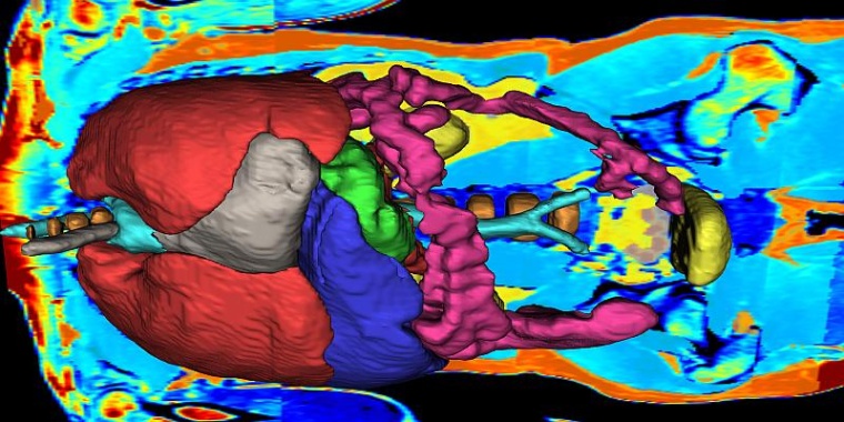 Mittels Künstlicher Intelligenz wurde diese Organdarstellung auf der Grundlage...