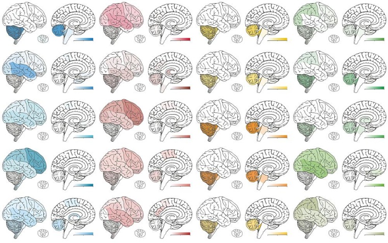 Je nach Lage im zentralen Nervensystem gehören Tumoren auch zu verschiedenen...