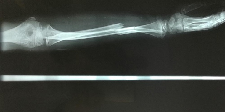 Foto: BIH / Sara Nabih